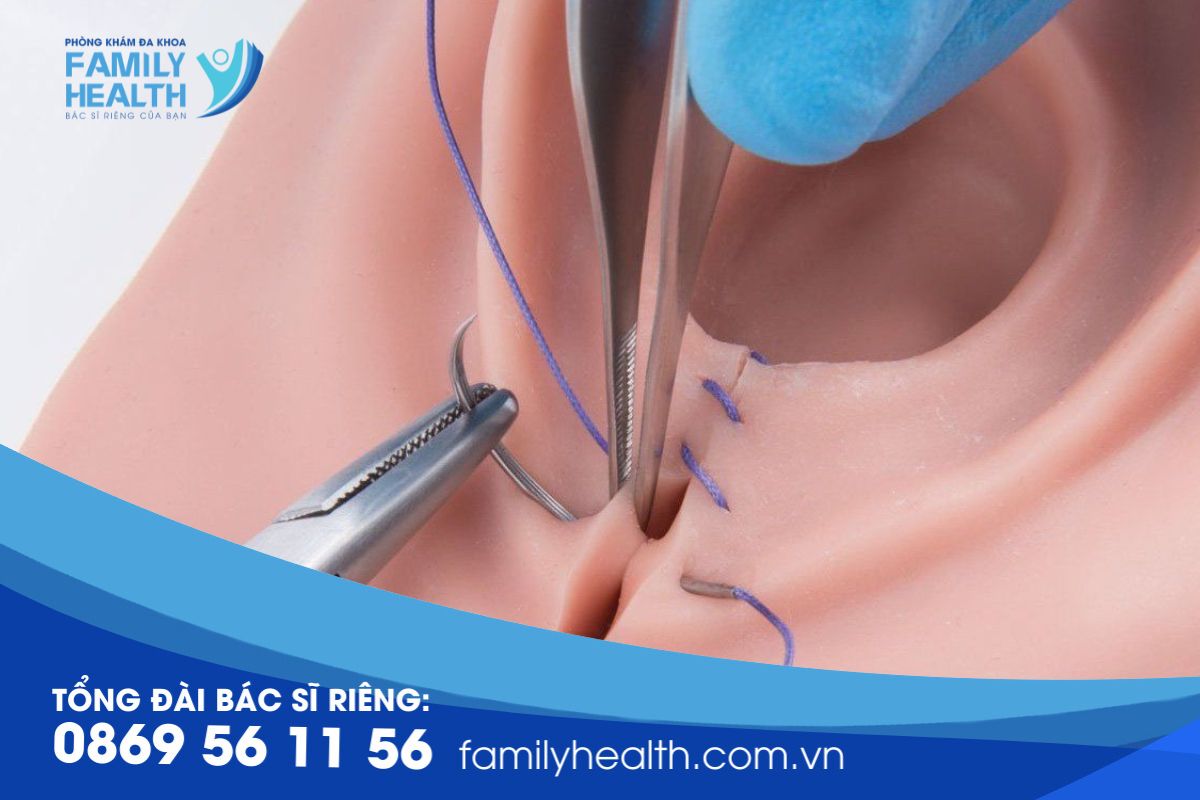 Khâu thẩm mỹ tầng sinh môn Family Health